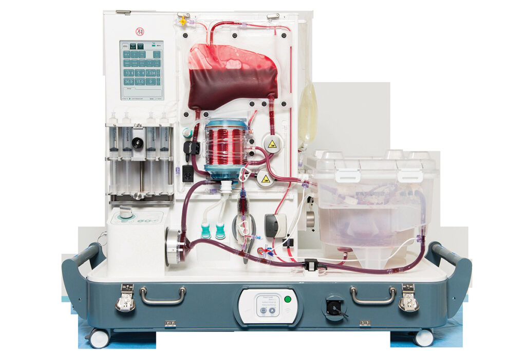 Metra organ preservation device by OrganOx